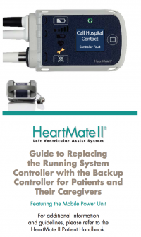 HeartMate II Guide to Replacing Controller_0.png